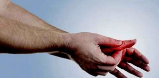 Artritis: ¿Qué es? sus causas, síntomas, consecuencias y tratamientos