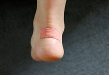 Celulitis infecciosa: qué es, causas, síntomas, tratamientos y más