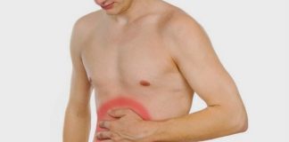 Peritonitis: causas, síntomas, tratamiento y más