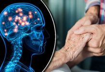 Enfermedad de Huntington: ¿Qué es? síntomas y más