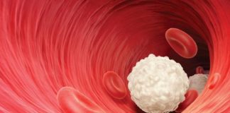 Hiperpotasemia: causas, síntomas, tratamientos y más