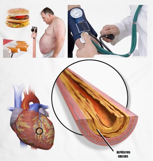Hipertensión arterial: causas, síntomas y tratamientos